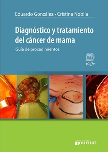 Diagnóstico Y Tratamiento Del Cáncer De Mama - Gonzalez