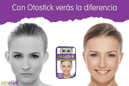 Imagen 6 de 8 de Corrector De Orejas Niños Y Adultos Otostick