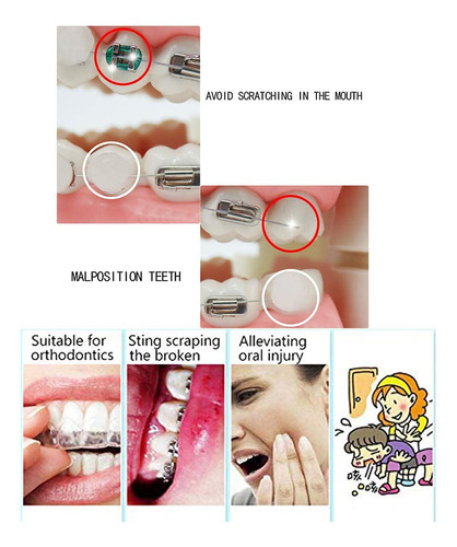 Chargenyang Cara Oral Dental Ortodoncia Cera Con Olor A Frut
