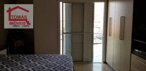 Imagem 22 de 27 de Lindo Sobrado 3 Suites - So1803