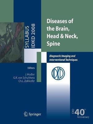 Diseases Of The Brain, Head & Neck, Spine - Jã¿â¼rg Hodle...
