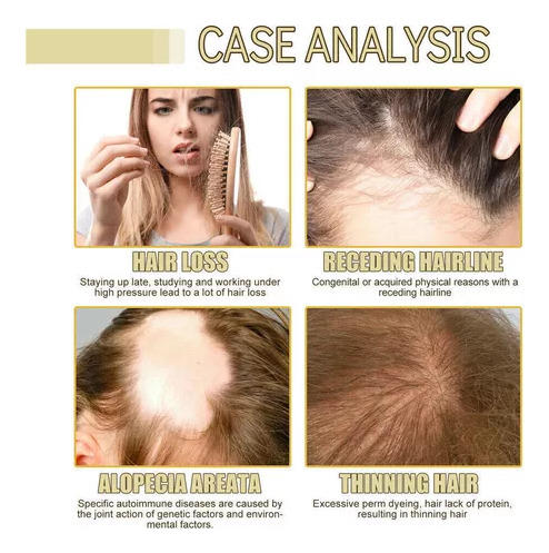 Aceite Para El Cuidado Del Cabello Vegano Natural Oleos 2p