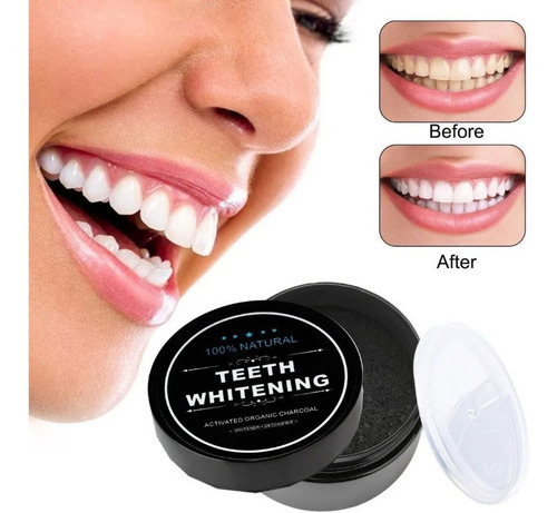 Blanqueador Dental Miracle Carbon Coco Natural Envio Gratis