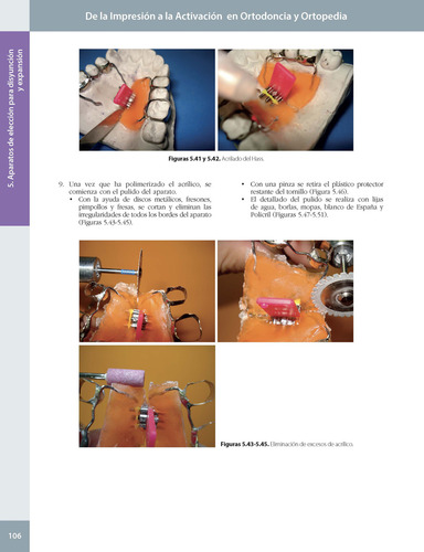 De La Impresión A La Activación En Ortodoncia Y Ortopedia. 2ª Edición. Incluye E-book, De Esequiel Rodríguez., Vol. 1. Editorial Amolca, Tapa Dura, Edición 2 En Español, 2024