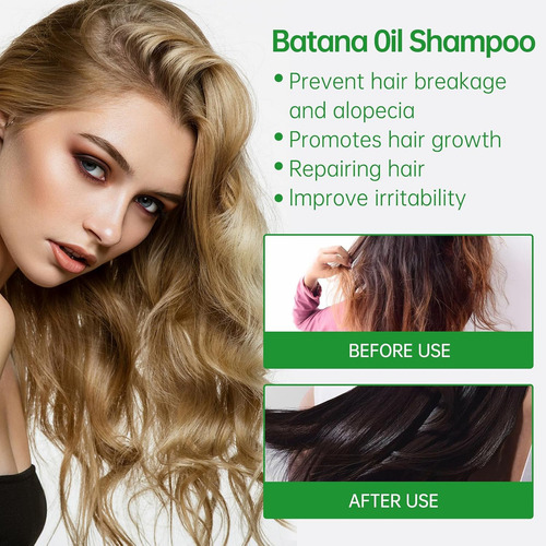 . Shampoo De Alecrim, Reduz A Perda De Cabelo, Macio E