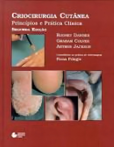Criocirurgia cutânea: Princípios E Prática Clínica, de Colver, Graham. Editorial Editora Manole Saúde, capa mole em português, 1999