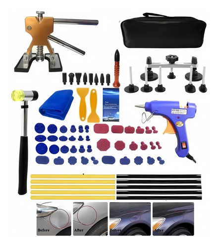 Kit Ventosas Saca Golpes Repara Abolladuras Auto 77pcs