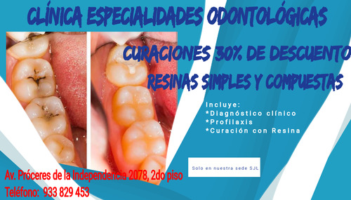 Brackets Para Ti, Corrige Tus Dientes