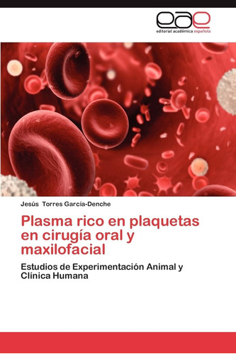 Libro: Plasma Rico En Plaquetas En Cirugía Oral Y Maxilofaci