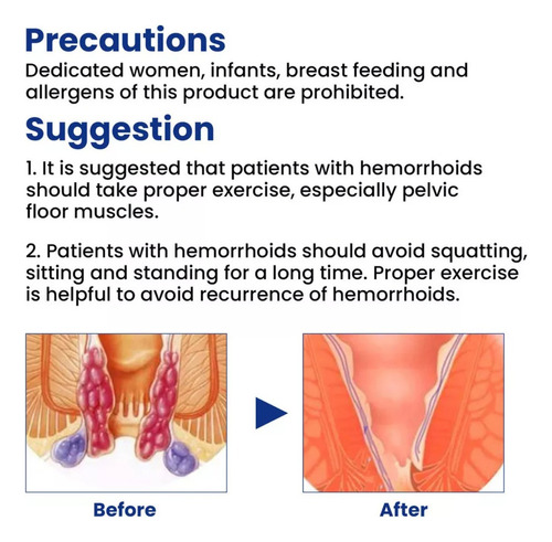 3× Crema For Hemorroides, Crema For Eliminar Hemorroides