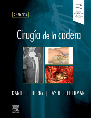 Cirugia De La Cadera 2ª Ed