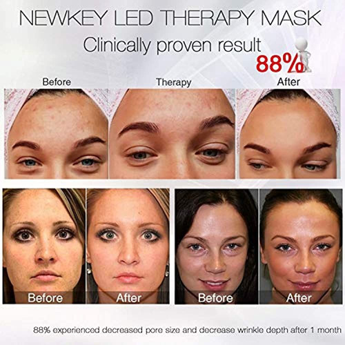 Mascarilla Facial Led Terapia De Luz, Newkey 7 Terapia De Lu