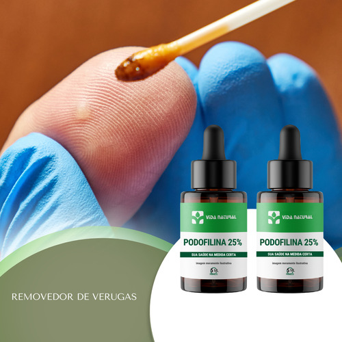 Kit com 2 doses de 25% de podofilina e 5 ml: tratamento tópico eficaz para verrugas genitais, perianais e cutâneas masculinas e femininas, uso seguro e específico