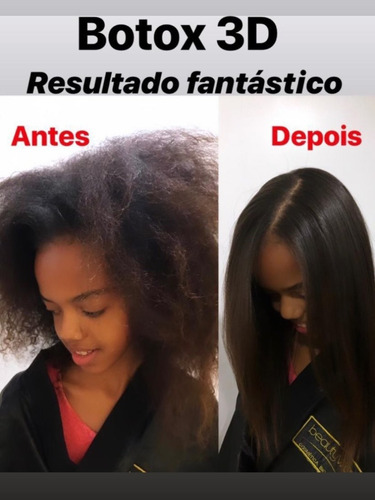 Imagem 2 de 2 de Bottox 3d Cherry Selagem, Redução E Tratamento.