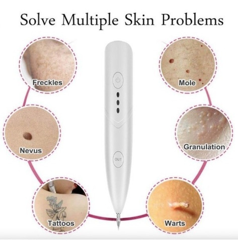 Imagen 3 de 8 de Lápiz Iones Elimina Pecas Lunares Verrugas Manchas Usb