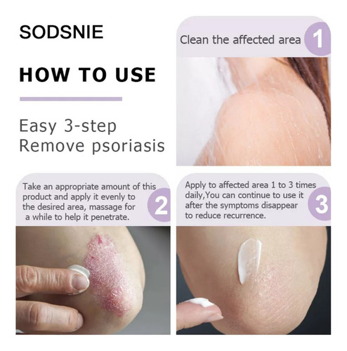 Crema F Para Psoriasis Y Cuidado De La Piel Ayurvédico Con