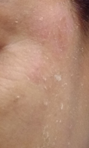 Imagen 2 de 2 de Crema Blanqueadora