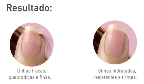 Base Fortalecedora Endurecedora De Unhas Blant Complexo 4x1