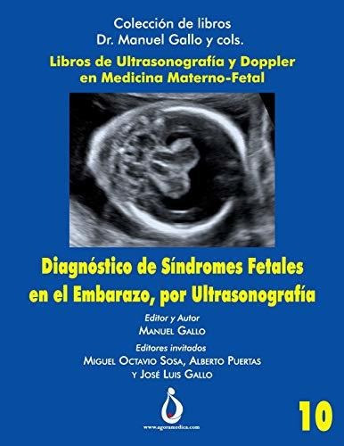 Diagnostico De Sindromes Fetales En El Embarazo, Por Ultrasonografia, De Manuel Gallo. Editorial Independently Published, Tapa Blanda En Español