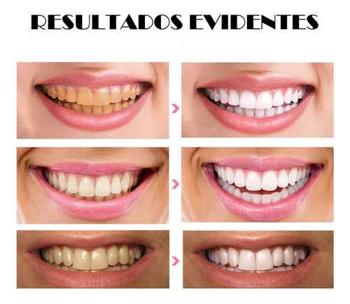 Blanqueador Dental Pasta Dental Pasta Blanqueamiento Dental