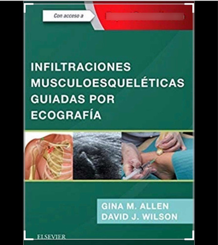 Infiltraciones Musculoesqueleticas