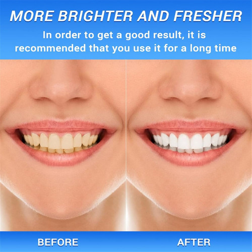 . Pasta De Dentes Branqueadora De Niacinamida Bodyaccel