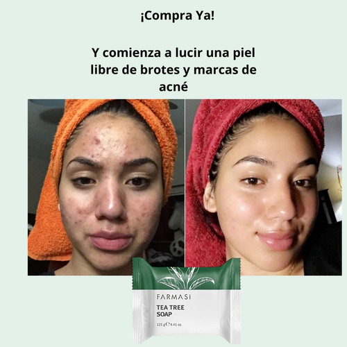 Jabon Tea Tree Farmasi Control De Acne Piel Grasa Y Mixta