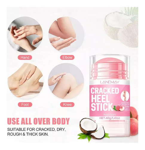 Crema Para Caminar Para Pees Hydrata Os Dry Pees