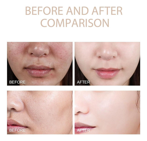 Exfoliante Exfoliante Facial Exfoliante Gel Limpiador