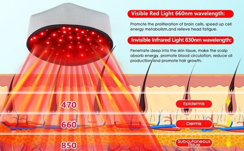 mesoterapia capilar a laser calvície BMC Crescimento de cabelo restauração de 1L 100g