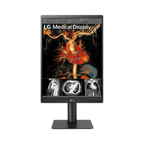 Monitor De Diagnostico LG 21.3` Ips 3mp Multi-resolucion 