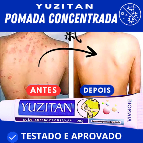 Creme Psoríase Dermatite Alergia Coceira Com Vermelhidão