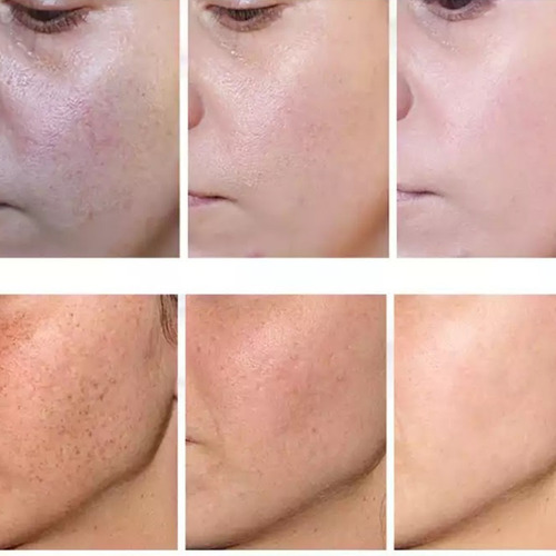 Imagem 3 de 3 de Sérum Retinol Anti Rugas E Bigode Chines Manchas Pele