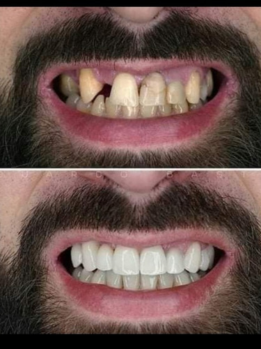 Imagem 1 de 1 de Arrume Seus Dentes No Boleto