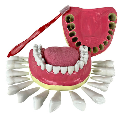 Dentição Com Todos Os Dentes Removíveis, Anatomia