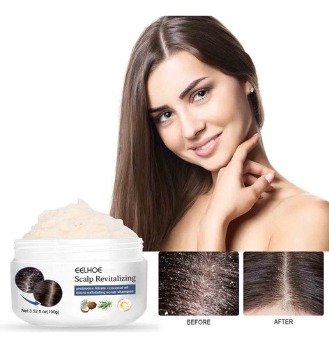 Shampoo De Enxofre Para Remover Piolhos, Aliviar A Coceira,
