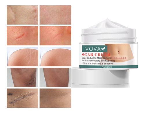 . Crema For Quitar Cicatrices Y Reparar La Piel, 2 Unidades,