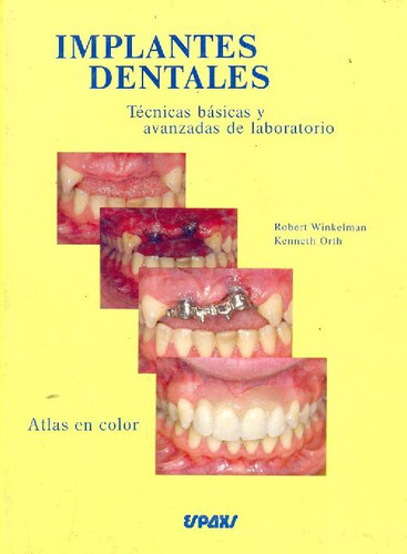 Libro Implantes Dentales De Robert Winkelman, Kenneth Orth