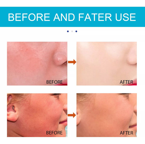 De 4pcs Barra Solar K Bio Para Rostro Y Cuerpo Bio Sun Stick