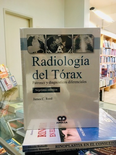 Libro - Radiología Del Tórax Patrones Y Diagnósticos Diferen