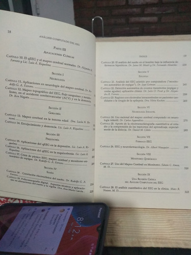 Análisis Computado Del Eeg - R. Ferrero, A. Ferrero (Usado)