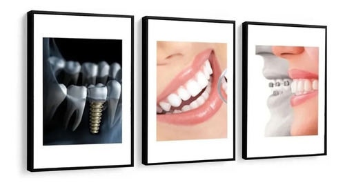 Quadro Mosaico Odontologia Dentista Com Moldura Dentes Decor