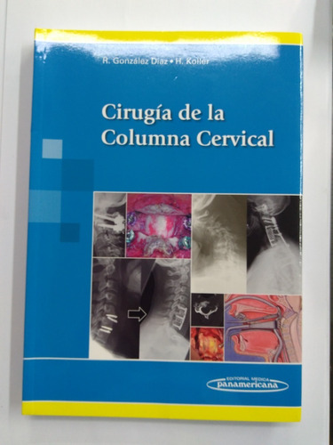 Cirugía De La Columna Cervical - R. González Diaz