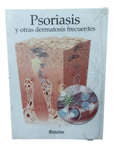 Miniatlas  Psoriasis Y Otras Dermatosis Frecuentesiui