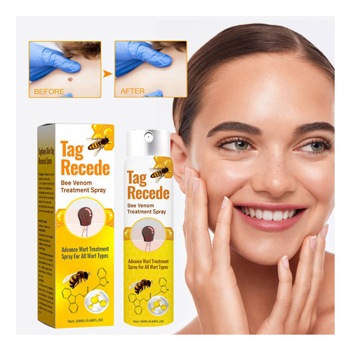 Crema Antipigmentaria Para Eliminar Las Verrugas Del Herpes,