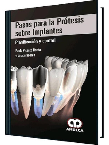 Libro - Pasos Para Prótesis Sobre Implantes. Planificación 