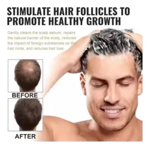 ChampĂș Root Activator Para El Crecimiento Del Cabello Para H