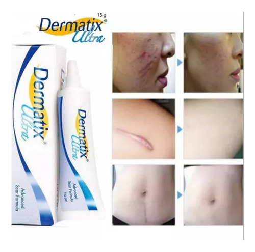 Elfleaf Dermatix Gel Tópico Desvanecedor De Cicatrices Gel Ultra Avanzado Desvanecedor De Cicatrices 15 Gm 2pcs