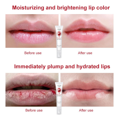Creme Labial Rosa, Clareamento Rápido, Branqueamento, Tratam