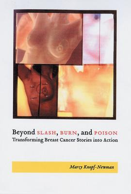 Libro Beyond Slash, Burn, And Poison - Marcy Jane Knopf-n...